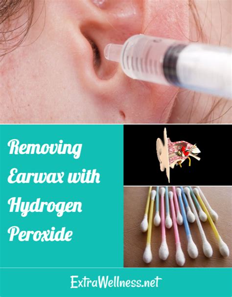 Removing Earwax With Hydrogen Peroxide Earwaxoil Ear Wax Buildup