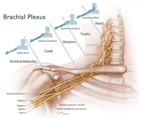 Supraclavicular Brachial Plexus Block Ideas Brachial Plexus My Xxx