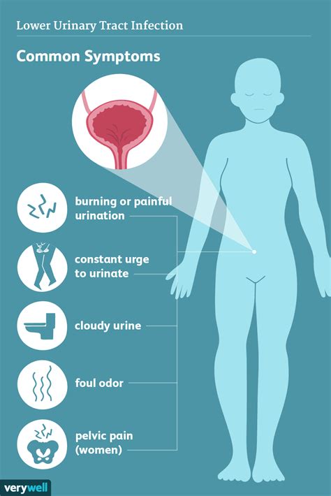 Symptomen Van Een Urineweginfectie Med Nl