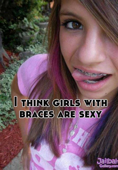 I Think Girls With Braces Are Sexy