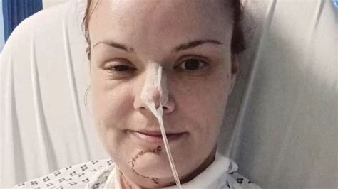 Mum With Cancer Defies The Odds And Speaks Again After Having 90 Of