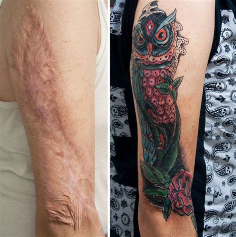 Scars Tattoo Cover Up Tattoos To Cover Scars Scars Tattoo Cover Up