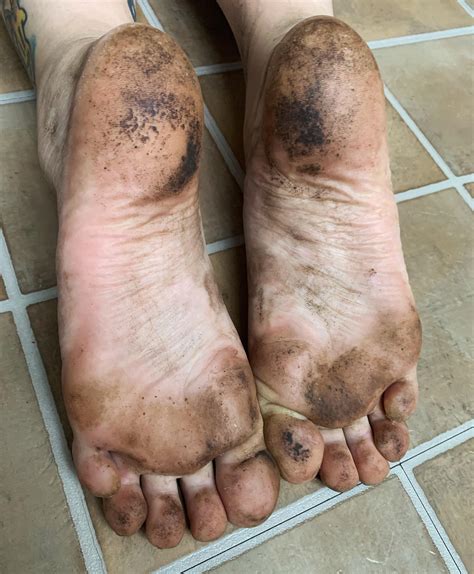 You Guys Asked For It — The Bottoms Of My Festival Feet Walked Many Miles Over The Weekend 😱😳🤪