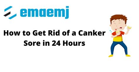 How To Get Rid Of A Canker Sore In 24 Hours Ema Emj