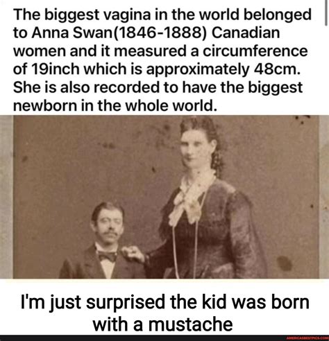The World S Largest Vagina Telegraph