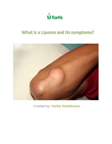 What Is A Lipoma And Its Symptoms