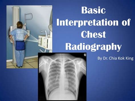 Basic Interpretation Of Cxr Ppt