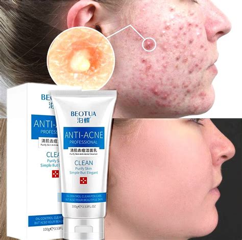 BEOTUA Pure Skin Anti Acne S Acne Solution Face Wash