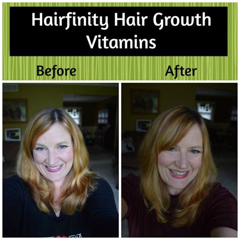 Vitamin c may help lower blood glucose spikes after meals in those with type 2 diabetes, but more research is needed. Hairfinity Hair Growth Vitamins | Beauty and Fashion Tech