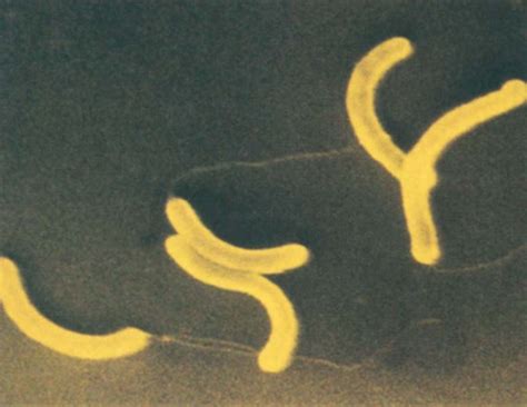 Biologija Najjednostavniji Oblici Ivota Na Zemlji Bakterije Vibrioni