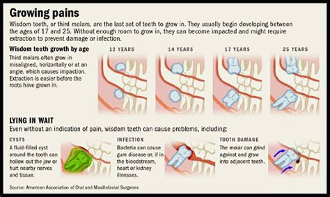 When Wisdom Teeth Start Growing Cythia Peeler