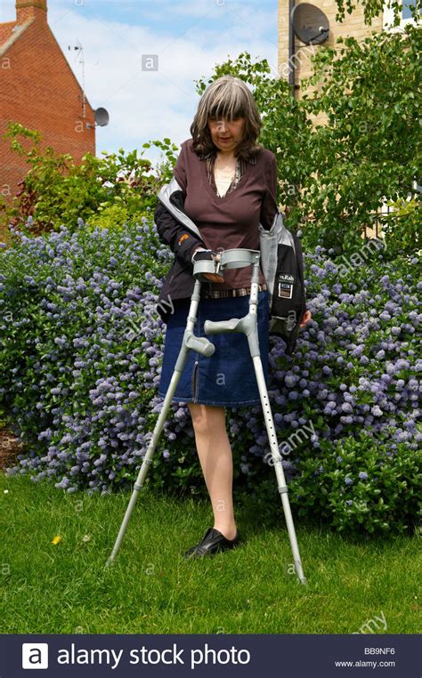 Amputee Lady Struggling To Get Out Of Coat Whilst Standing