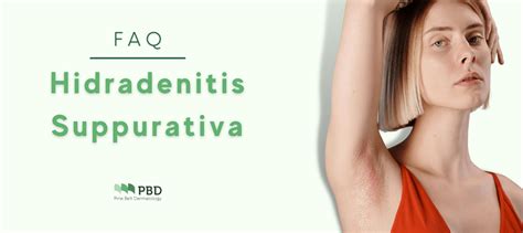 Hidradenitis Suppurativa Faq