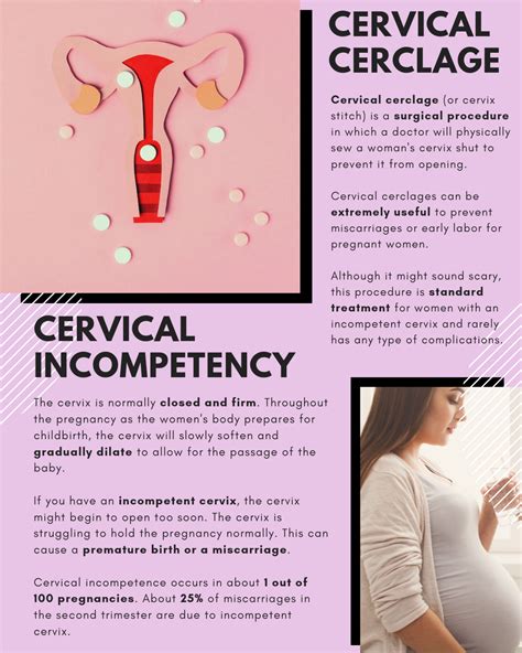 cervical cerclage during pregnancy