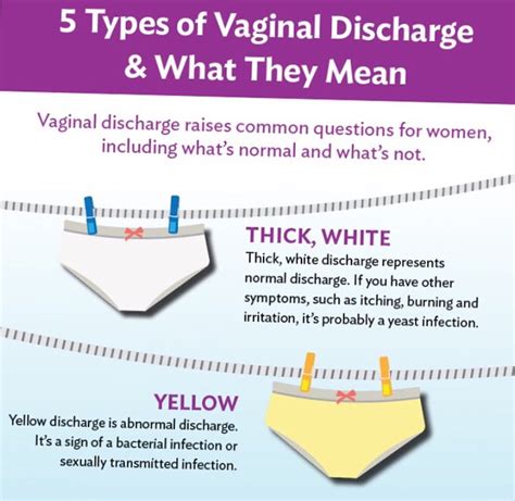 Normal Discharge In Women