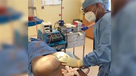 Brazilian Butt Lift Procedure With Dr Jones YouTube