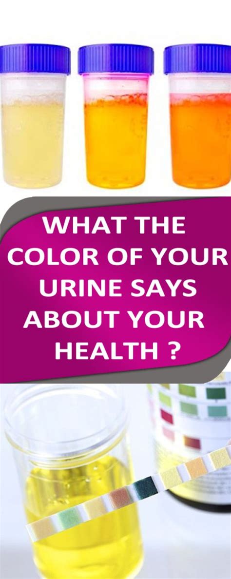 What The Color Of Your Urine Says About Your Health Health Urinal Tips