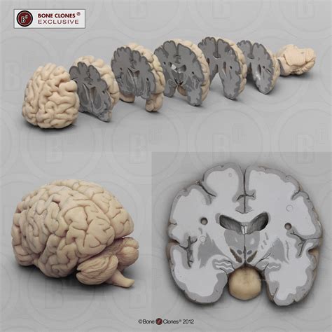Human Brain Multiple Coronal Sections Bone Clones Inc