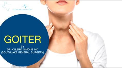 Goiter Causes Symptoms Treatment And Surgery Youtube