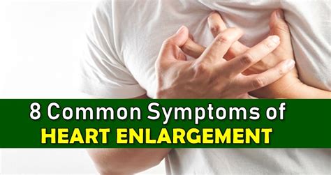 Heart Enlargement Symptoms 8 Warning Signs Of Mild Cardiomegaly