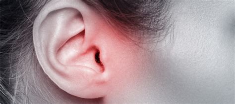 ما أسباب التهاب الأذن الوسطى؟ وكيف يمكن علاجها؟