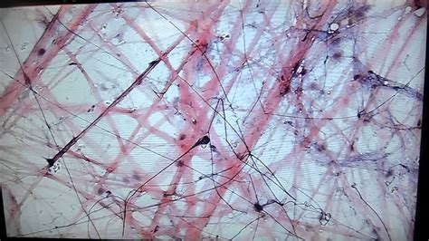 This tissue is found during the body under the skin and linking organs and other tissues. A&P1 Lab#3 areolar connective tissue - YouTube