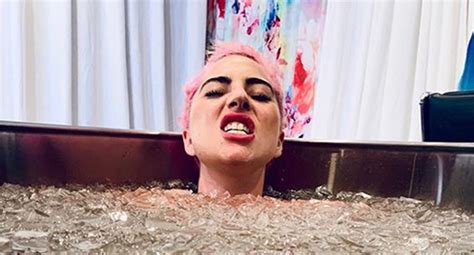 Lady Gaga Shares Photo From Ice Bath After Falling Off Stage Lady Gaga Just Jared Celebrity