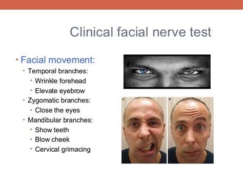 Facial Nerve Testing