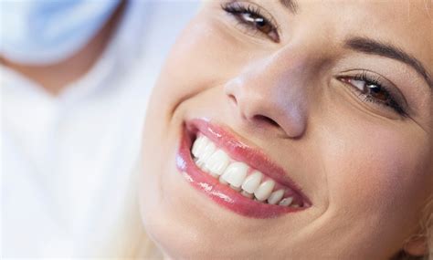Limpieza Dental Y Empastes Clínica Ama Dental Groupon
