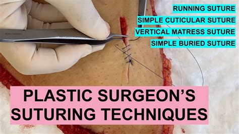 Plastic Surgeons Suture Techniques Running Simple Cuticular
