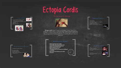 Ectopia Cordis By Katelyn Bird On Prezi Next