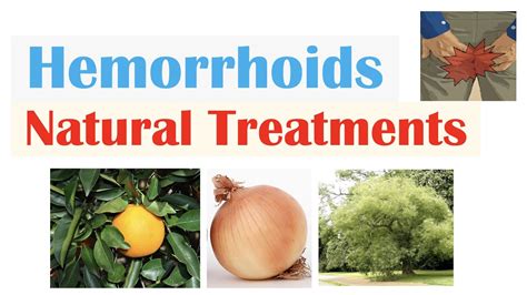 How To Treat Hemorrhoids Natural Treatments Plant Flavonoids For Hemorrhoidal Disease