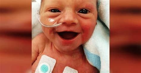 Premature Baby With A Loveable Smile Breathes New Hope Into Worried Parents