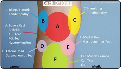 A Brief Introduction About Knee Pain Location Chart