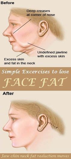 7 Jaw Release This Jaw Exercise Will Help You To Get High Cheekbones
