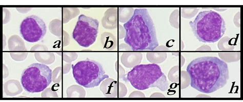 Examples Of The Different Lymphocytes Lymphocytes Classified As A