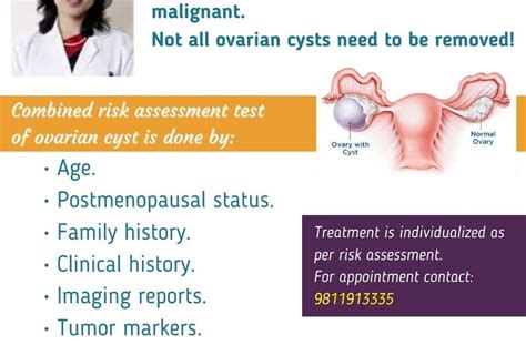 Dr Sarika Gupta Treatment Of Ovarian Cysts