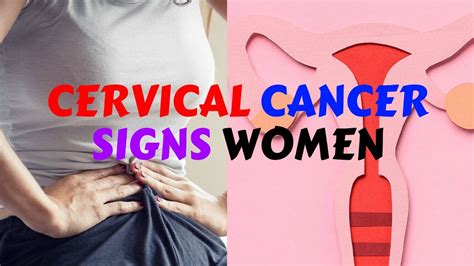 Cervical Cancer Signs Women Should Be Aware Of YouTube