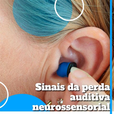 Sinais Da Perda Auditiva Neurossensorial