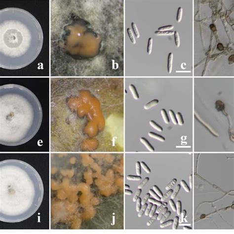Morphological And Phenotypic Characters Of Colletotrichum Species