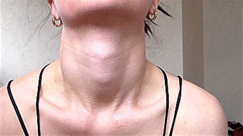 protruding adam s apple miss clip miss love clips4sale