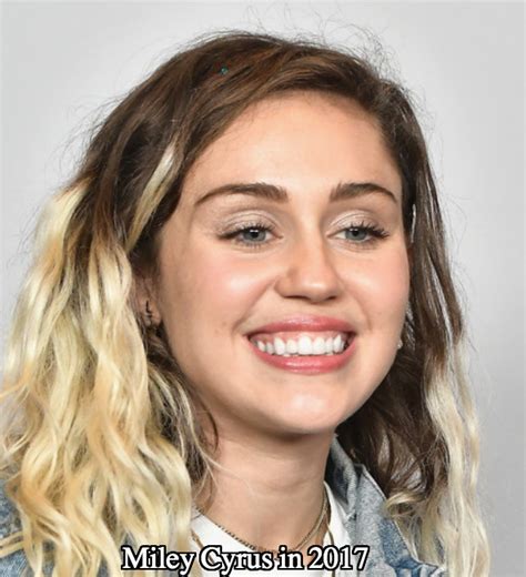 Miley Cyrus Teeth Did Miley Cyrus Fix Her Teeth