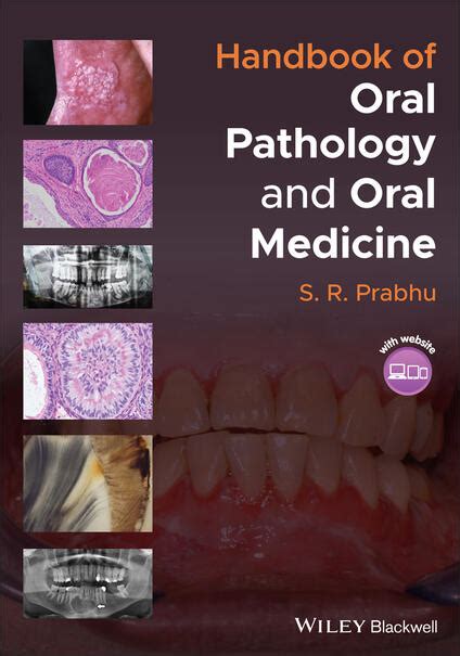 Handbook Of Oral Pathology And Oral Medicine S R Prabhu Libro In