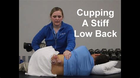 advanced cupping techniques myofascial decompression for a stiff low back lbp youtube