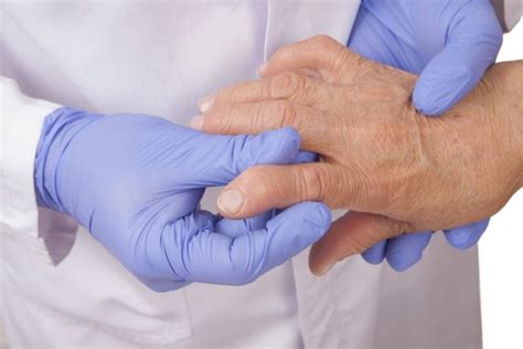 10 Symptoms Of Arthritis Facty Health