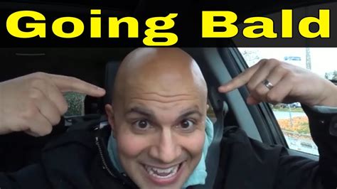 5 Pros Of Going Bald At 20 Years Old Youtube
