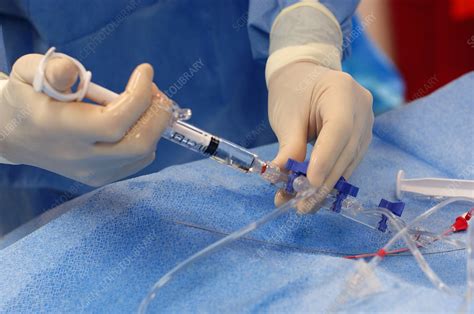 Administering Local Anesthetic Stock Image C0015409 Science
