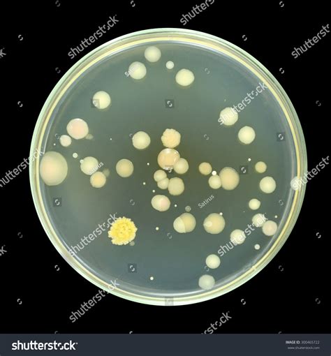 Colonies Of Bacteria From Sea Water On A Petri Dish Agar Plate