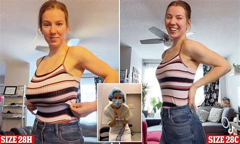 Woman Whose Size H Breasts Caused Migraines And Pain Undergoes