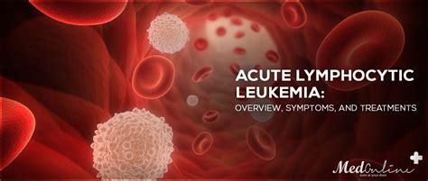 Acute Lymphocytic Leukemia Overview Symptoms And Treatments